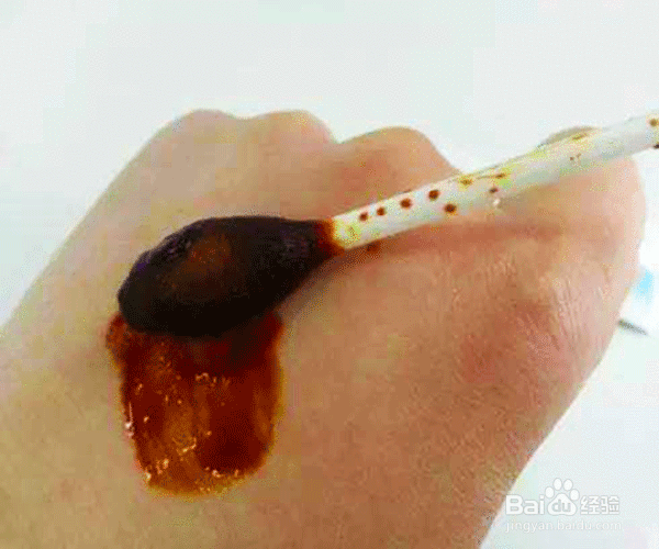 被自己家狗刮破皮了没出血怎么办