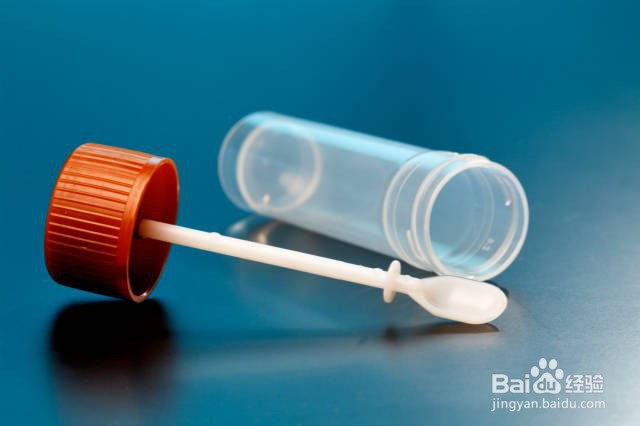 大便常规标本怎么采集？