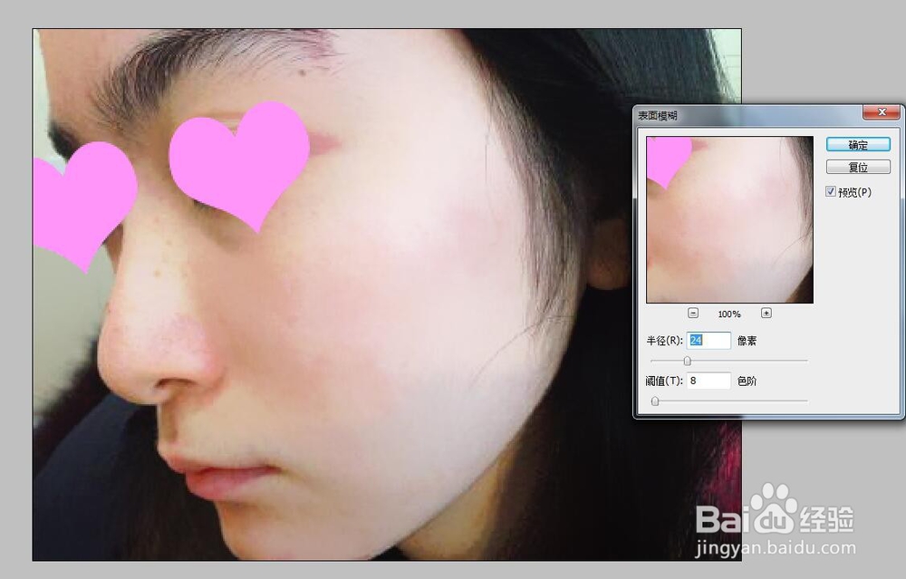 PS怎么去掉照片脸上的痘印斑点