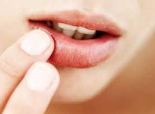 冬季如何避免嘴唇干燥起皮？