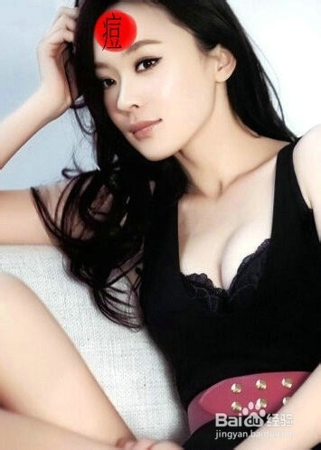 怎样去除脸部痘痘不留疤痕