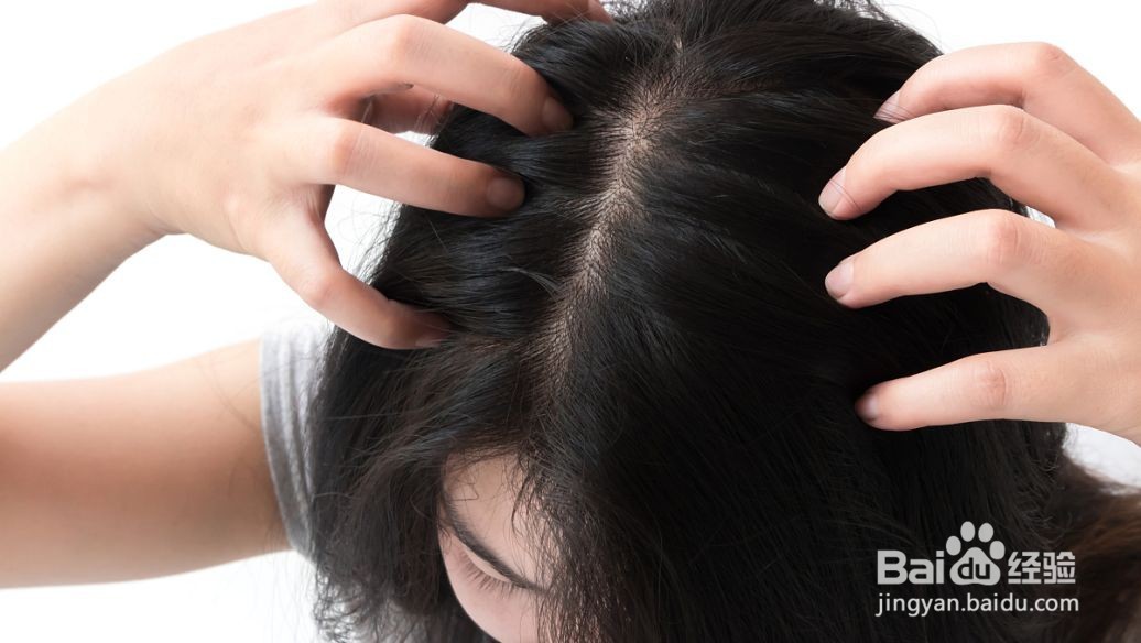 硫磺皂洗头的作用与功效