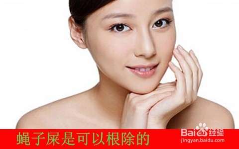 脸上有苍蝇屎怎么去除/最简单去蝇子屎方法