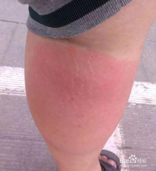 大暴雨来临长期泡在水里该怎么办?