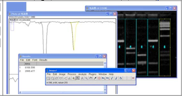 Image J软件进行图片条带灰度值分析