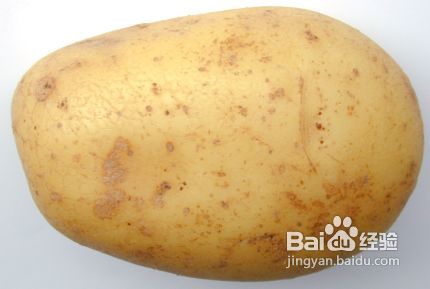 肋间神经痛的症状