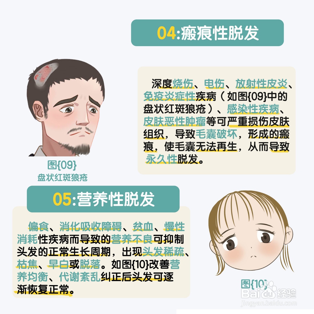 造成脱发的原因