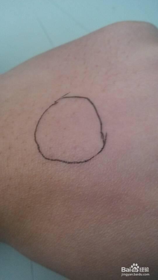 紫外线光疗仪：[5]遮挡篇