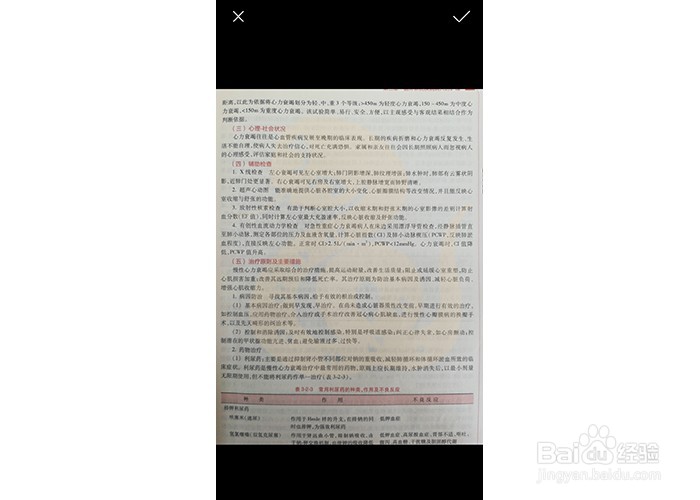 怎么用微信小程序识别图片中的文字