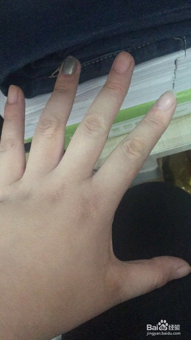 关于手部白斑遮盖的一些方法