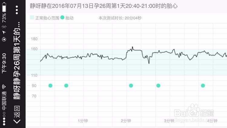 怎样及时发现胎儿缺氧