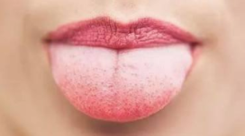 怎么样刷牙才能除口臭？