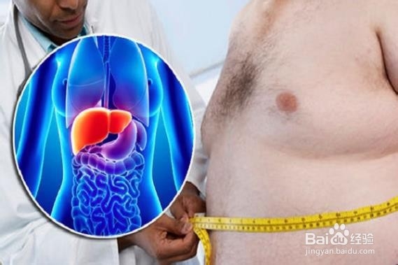 有助于平衡脂肪肝的食物