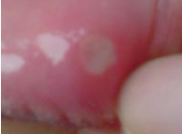 家庭备用蜂蜜的妙用小招