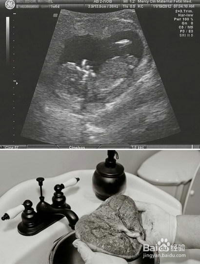 盘点十大奇葩有趣的心形物体