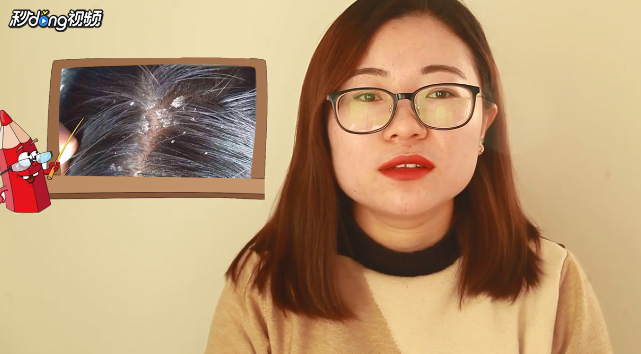 什么洗发水去屑效果好