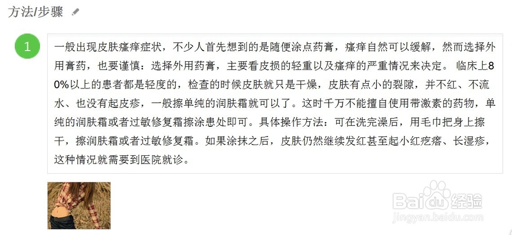 皮肤瘙痒用什么药膏