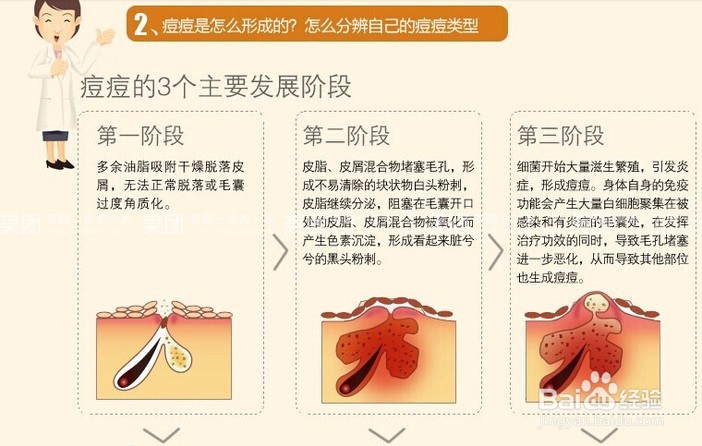 清洗毛孔怎么做，怎么清洁毛孔？