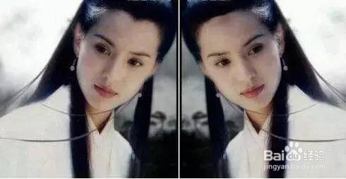 M型 美人尖如何区分