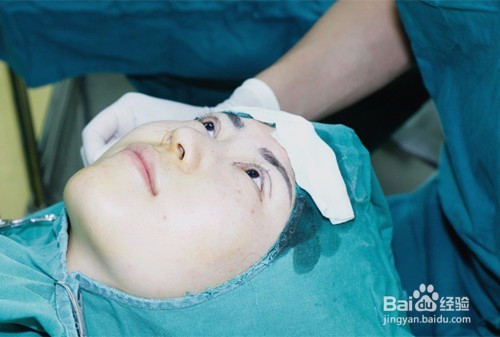 做了双眼皮，整个人美美哒