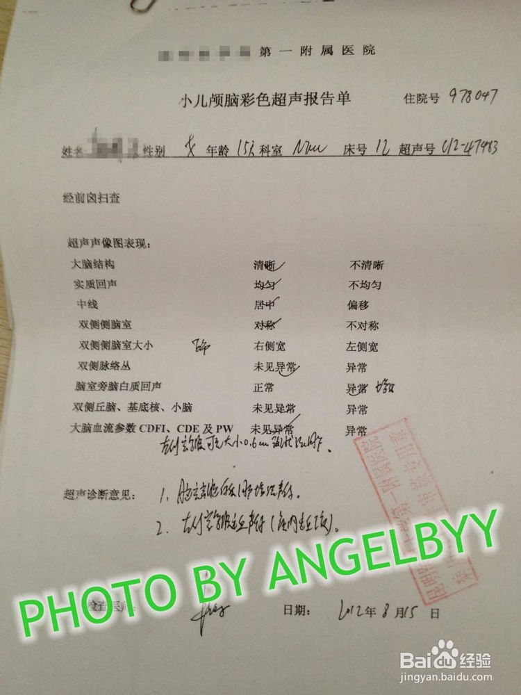 家有早产儿之颅脑出血