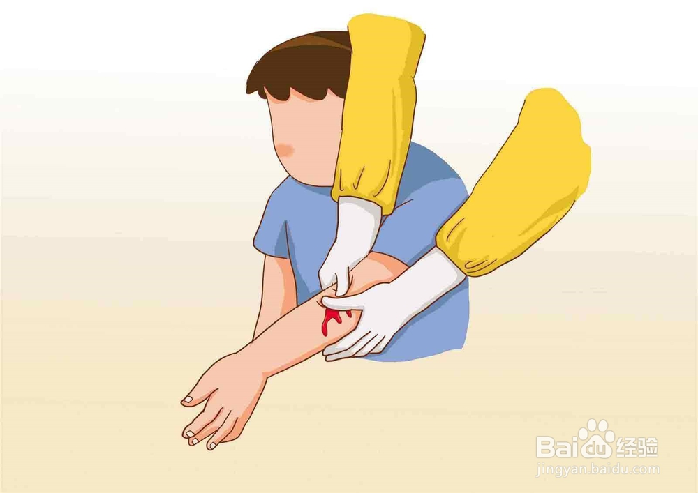 给家养猫打针针头戳破手指出血怎么办