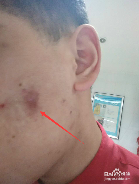 不同人群的便秘问题形成原因以及应该如何缓解