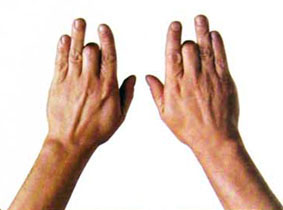 弹筝者怎样锻炼手指的灵活度