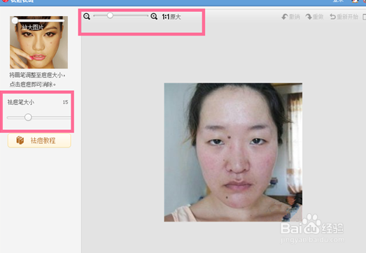 美图秀秀祛痘磨皮方法与技巧