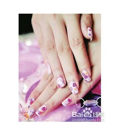 灰指甲怎么治,灰指甲用什么药好