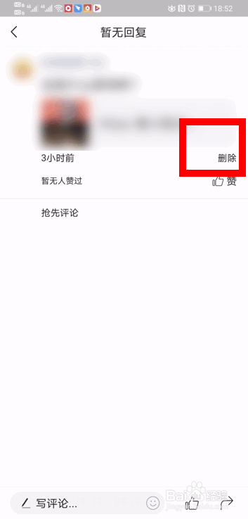 今日头条怎么删除自己的评论？