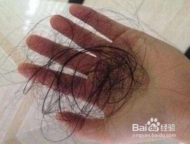 生活中如何改善掉头发