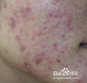 清除身体的宿便，能减肥!!!