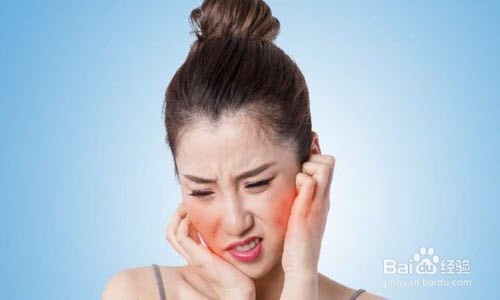 怎样祛除脸部红血丝