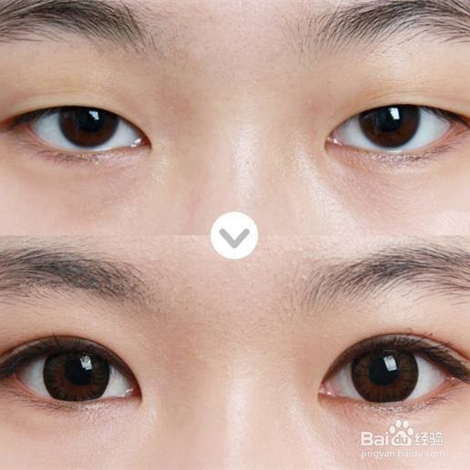 如何把双眼皮做得自然不露痕迹