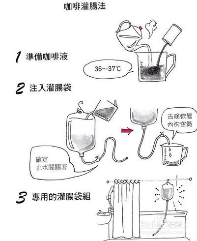 清洁灌肠怎样灌干净