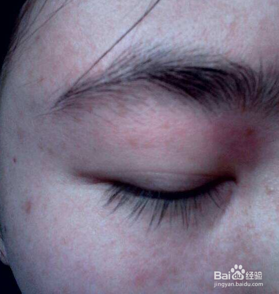 脸上容易长斑是由坏习惯引起的吗