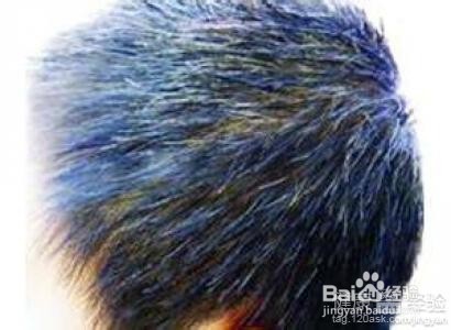 掉发的原因是那些？