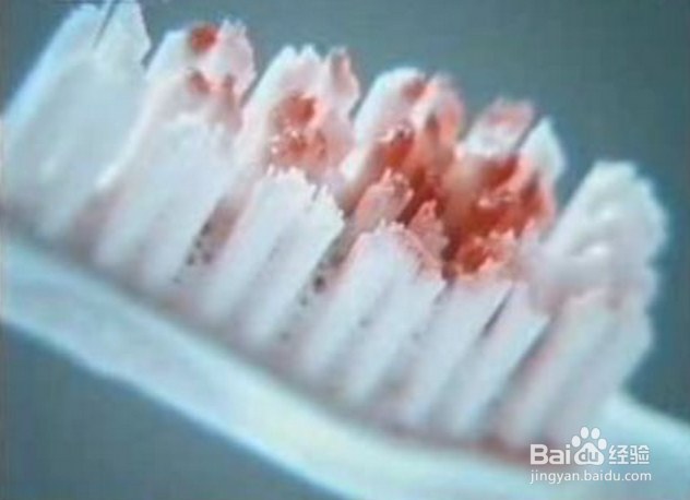 <b>每天刷牙牙齿都会出血是怎么回事</b>
