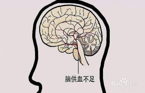 经常不做运动的话，对身体有什么危害呢？