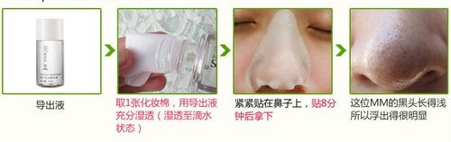 怎么才能去除黑头