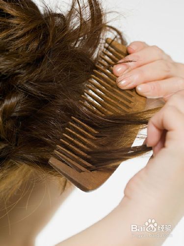 脱发应该怎么办