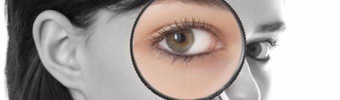 青光眼形成的原因有哪些