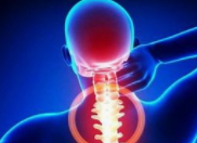 颈椎病症状体征