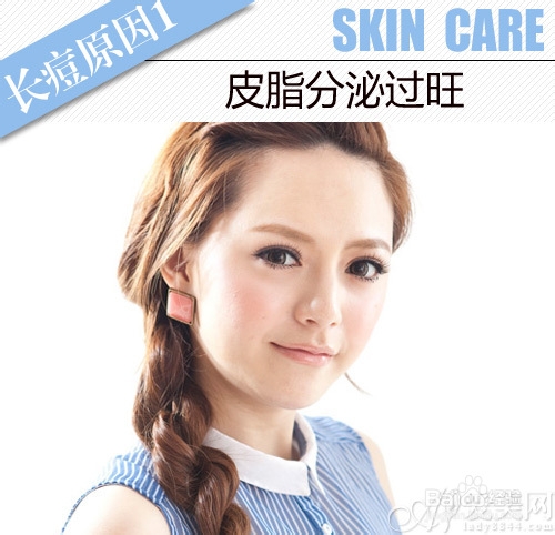 冬日祛痘只需4步