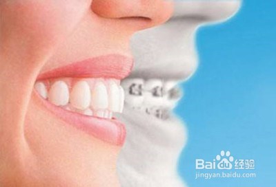 保持器分几种？