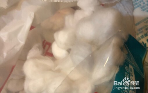 糖尿病人拔牙可以拔牙么