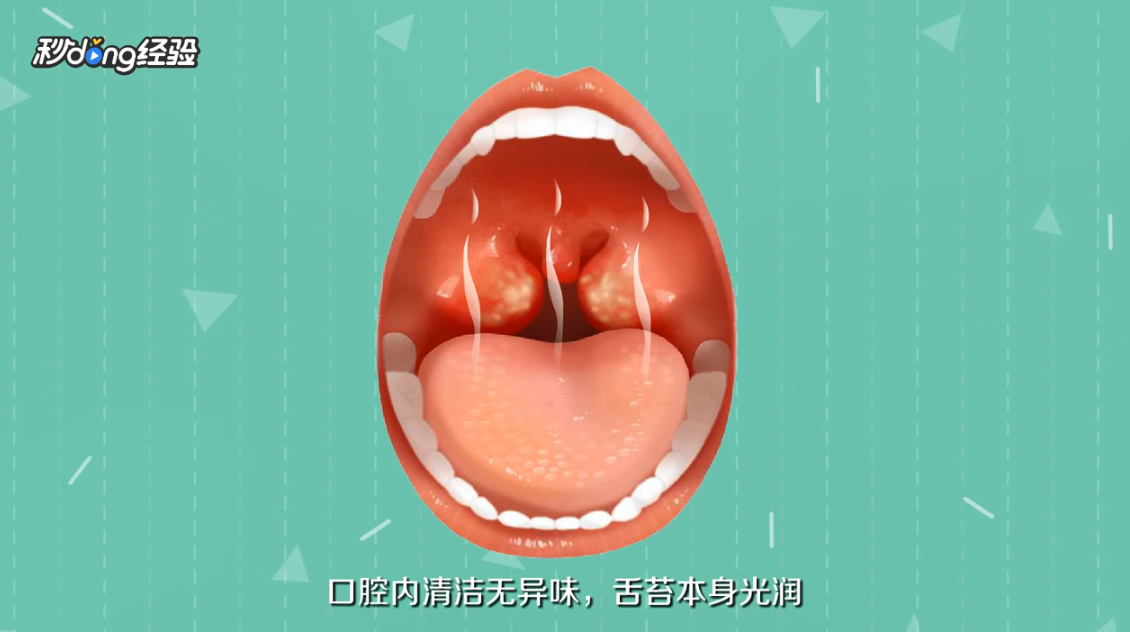 舌苔颜色各代表什么意思