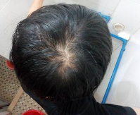 怎样根据头部判断身体所需补充的营养