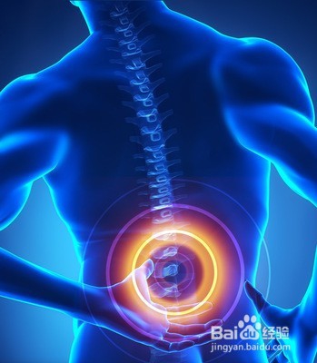 腰间盘突出最简单的治疗方法